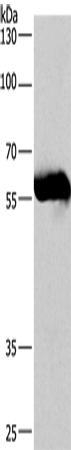 Anti-Human/Mouse CORO1C Antibody - ABMIUM
