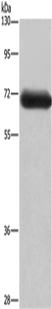 Anti-Human/Mouse/Rat DPYSL3 Antibody - ABMIUM