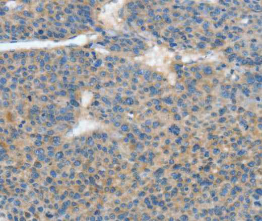 Anti-Human/Mouse/Rat ATP4B Antibody