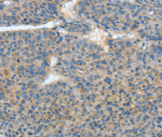 Anti-Human/Mouse/Rat ATP4B Antibody - ABMIUM