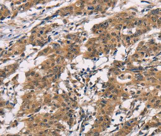 Anti-Human/Mouse/Rat ADGRB1 Antibody
