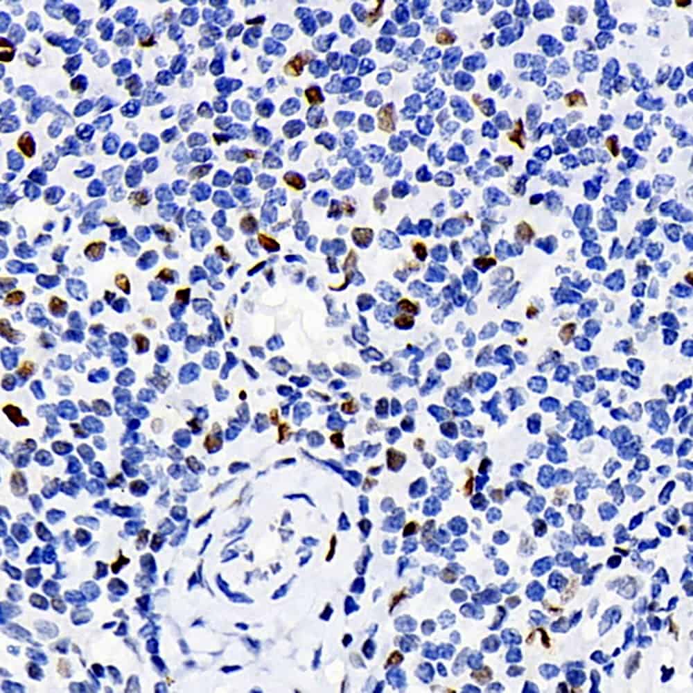 Immunohistochemistry analysis of paraffin-embedded human tonsil using ERK 2 Polyclonal Antibody at dilution of 1:100.
