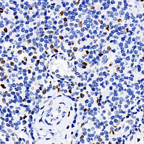 Immunohistochemistry analysis of paraffin-embedded human tonsil using ERK 2 Polyclonal Antibody at dilution of 1:100.