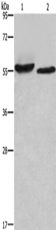 Anti-Human/Mouse/Rat AMIGO2 Antibody - ABMIUM