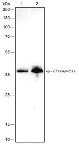 Anti-Human CAB39/MO25 Antibody [A451]
