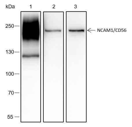 Anti-Human/Rat/Mouse NCAM1/CD56 Antibody [A410] - ABMIUM