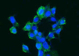 Anti-Human CA14 Antibody [A1205] - ABMIUM