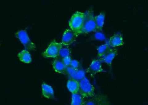 Anti-Human CA14 Antibody [A1205] - ABMIUM