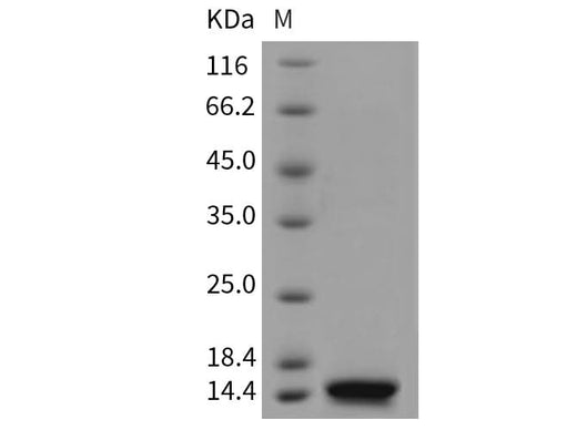 SDS-PAGE analysis of Mouse B2M/Beta-2-microglobulin proteins, 2 μg/lane of Recombinant Mouse B2M/Beta-2-microglobulin proteins was resolved with SDS-PAGE under reducing conditions, showing bands at 12 kDa.