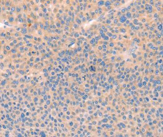 Anti-Human CD109 Antibody