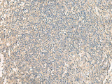Immunohistochemistry of paraffin-embedded Human tonsil tissue using NRBP1 Polyclonal Antibody at dilution of 1:60(×200)