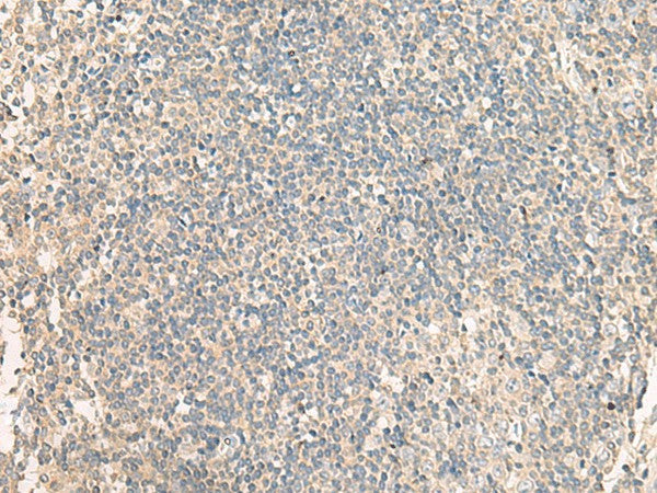 Immunohistochemistry of paraffin-embedded Human tonsil tissue using NRBP1 Polyclonal Antibody at dilution of 1:60(×200)