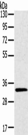 Anti-Human/Mouse/Rat STK16 Antibody