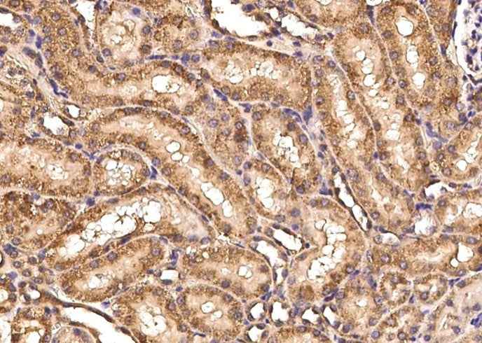 Anti-Rat ART4 Antibody [A1109] - ABMIUM