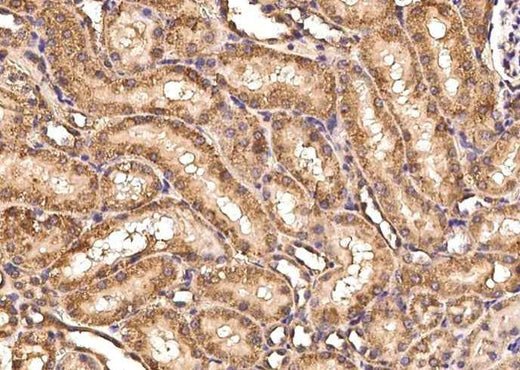 Anti-Rat ART4 Antibody [A1109] - ABMIUM
