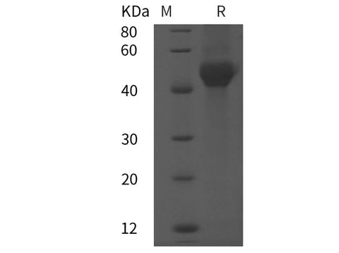 SDS-PAGE analysis of Rat SHBG/ABP proteins, 2 μg/lane of Recombinant Rat SHBG/ABP proteins was resolved with SDS-PAGE under reducing conditions, showing bands at 45 kDa.