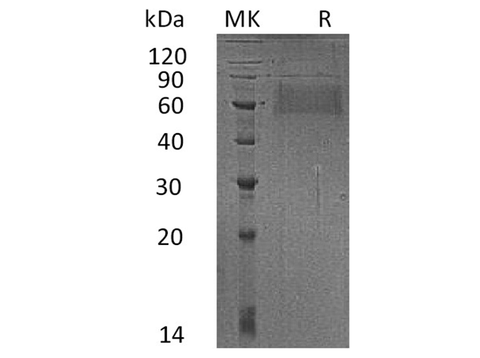 Recombinant Human SELL Protein (His Tag) - ABMIUM