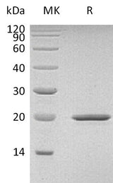 Recombinant Mouse Sonic Hedgehog/SHH Protein - ABMIUM