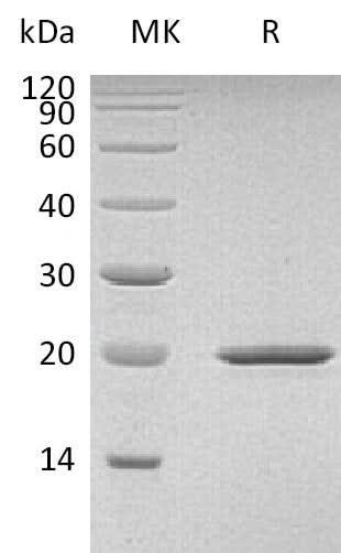 Recombinant Mouse Sonic Hedgehog/SHH Protein - ABMIUM