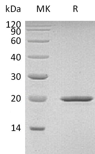 Recombinant Mouse Sonic Hedgehog/SHH Protein - ABMIUM