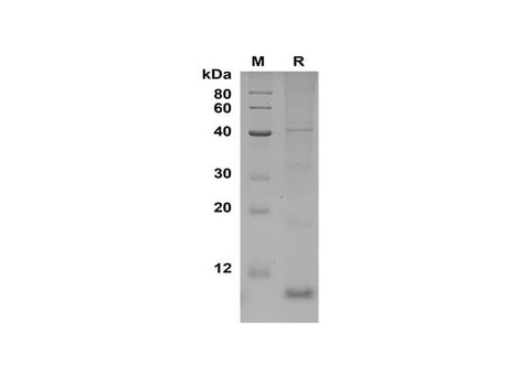 SDS-PAGE analysis of Human CCL22 proteins, 2 μg/lane of Recombinant Human CCL22 proteins was resolved with SDS-PAGE under reducing conditions, showing bands at 10 kDa.