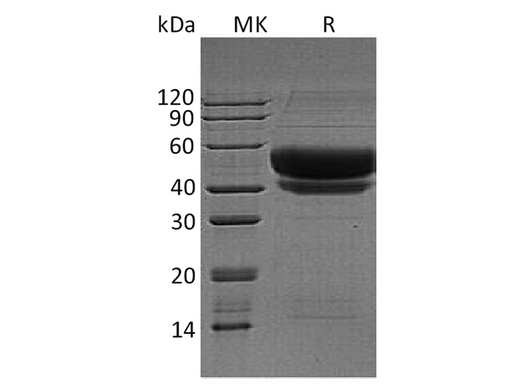 Recombinant Human ST6GAL1 Protein (His Tag) - ABMIUM