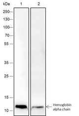 Anti-Human/Rat/Mouse Hemoglobin alpha Antibody [A245]