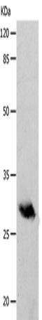 Anti-Human/Mouse/Rat POMC Antibody - ABMIUM