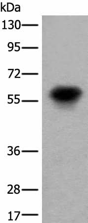 Western blot analysis of Human fetal brain tissue lysate using CDT1 Polyclonal Antibody at dilution of 1:550