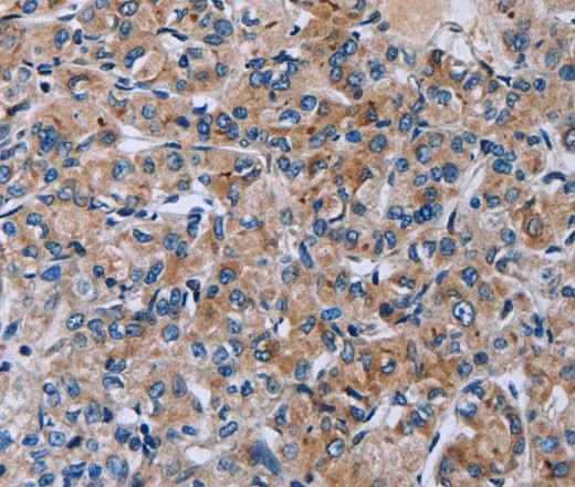 Anti-Human HSD3B2 Antibody