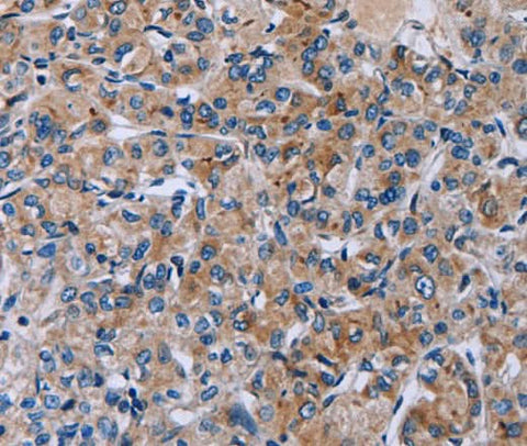 Anti-Human HSD3B2 Antibody - ABMIUM