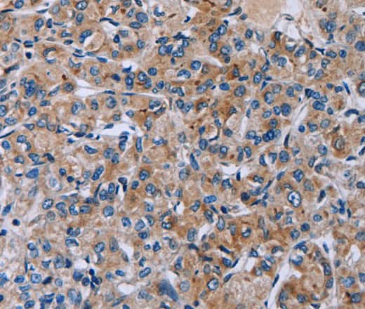 Anti-Human HSD3B2 Antibody - ABMIUM