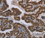 Anti-Human/Mouse/Rat MYCN Antibody - ABMIUM
