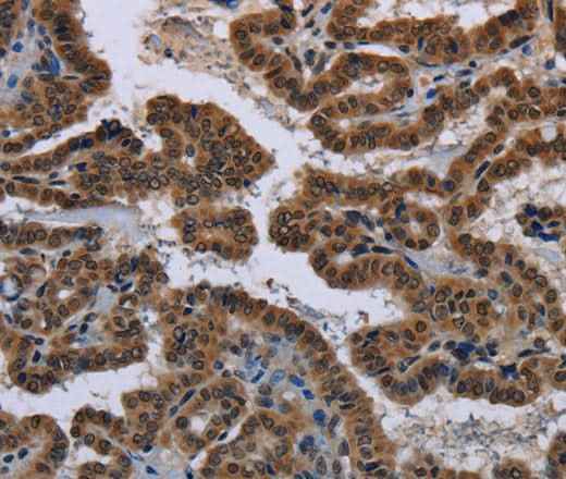 Anti-Human/Mouse/Rat MYCN Antibody