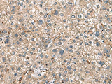 Anti-Human HLA-DRA Antibody - ABMIUM