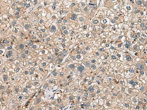 Anti-Human HLA-DRA Antibody - ABMIUM