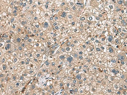 Anti-Human HLA-DRA Antibody - ABMIUM