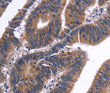 Anti-Human/Mouse NFATC3 Antibody - ABMIUM
