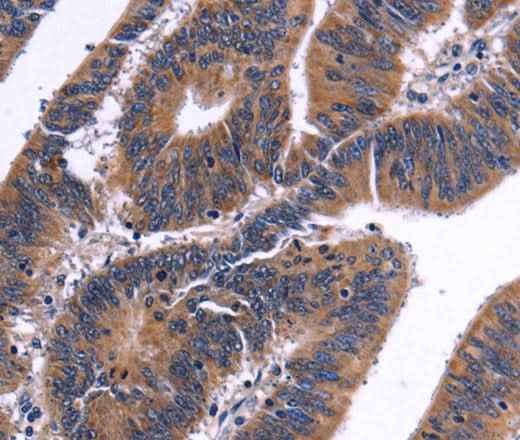 Anti-Human/Mouse NFATC3 Antibody