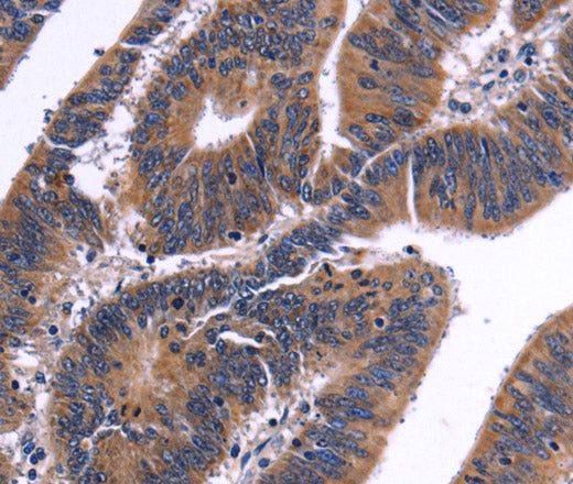Anti-Human/Mouse NFATC3 Antibody - ABMIUM