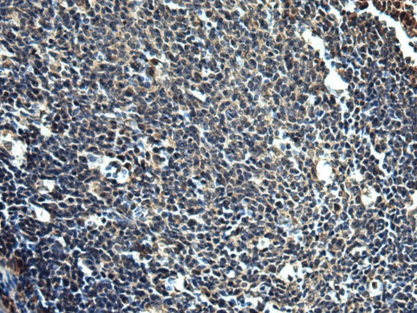 Immunohistochemistry of paraffin-embedded Human tonsil tissue using PRRT2 Polyclonal Antibody at dilution of 1:50(×200)