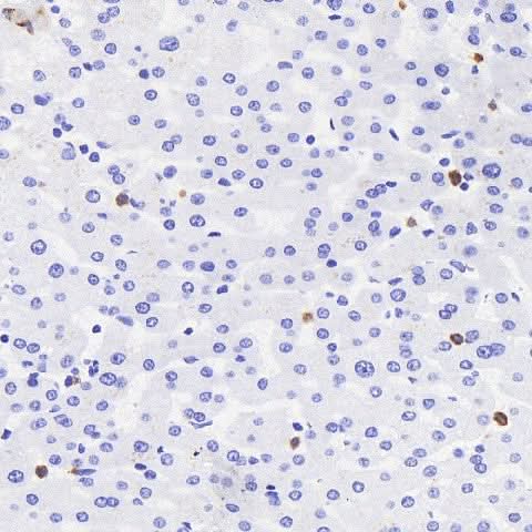 Immunohistochemistry analysis of paraffin-embedded human liver using MPO Polyclonal Antibody at dilution of 1:300.