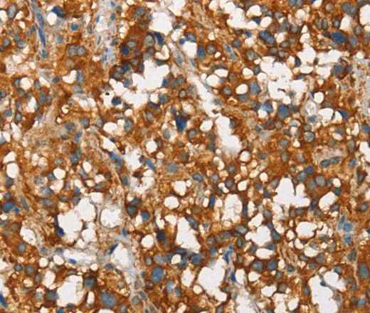 Anti-Human/Mouse/Rat SNCA Antibody