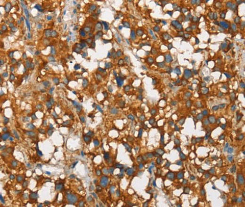 Anti-Human/Mouse/Rat SNCA Antibody - ABMIUM