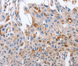 Anti-Human/Mouse NRG4 Antibody - ABMIUM