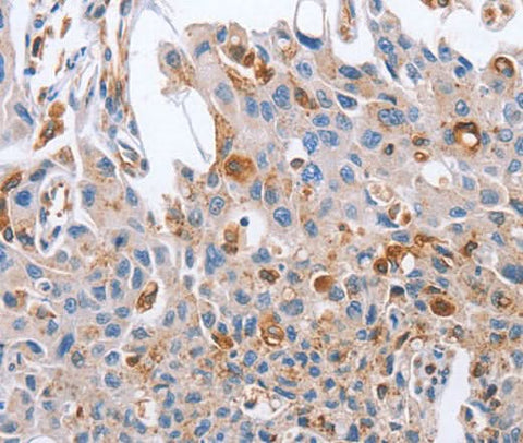 Anti-Human/Mouse NRG4 Antibody - ABMIUM
