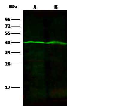 Anti-Human FH Antibody [A925] - ABMIUM