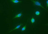 Anti-Human CCNA1 Antibody [A1049] - ABMIUM