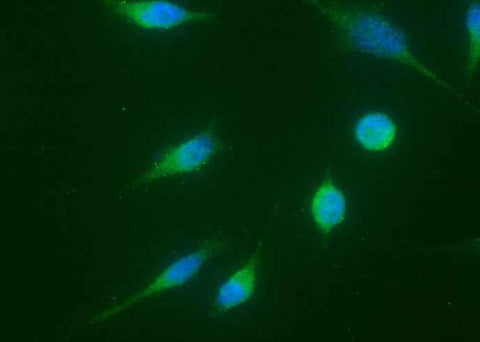 Anti-Human CCNA1 Antibody [A1049] - ABMIUM