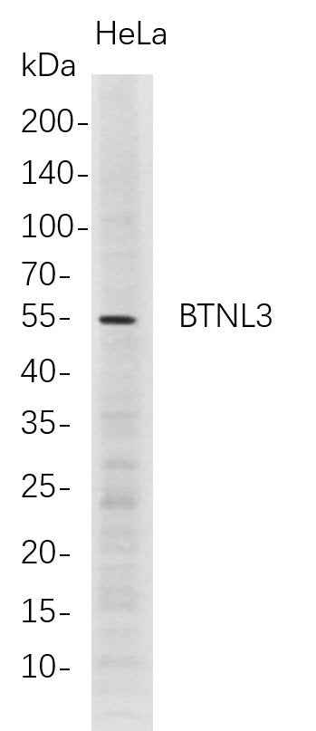 Anti-Human BTNL3 Antibody [B702] - ABMIUM